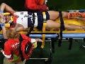 French gymnast breaks leg during vault in Rio French gymnast breaks leg during vault in Rio